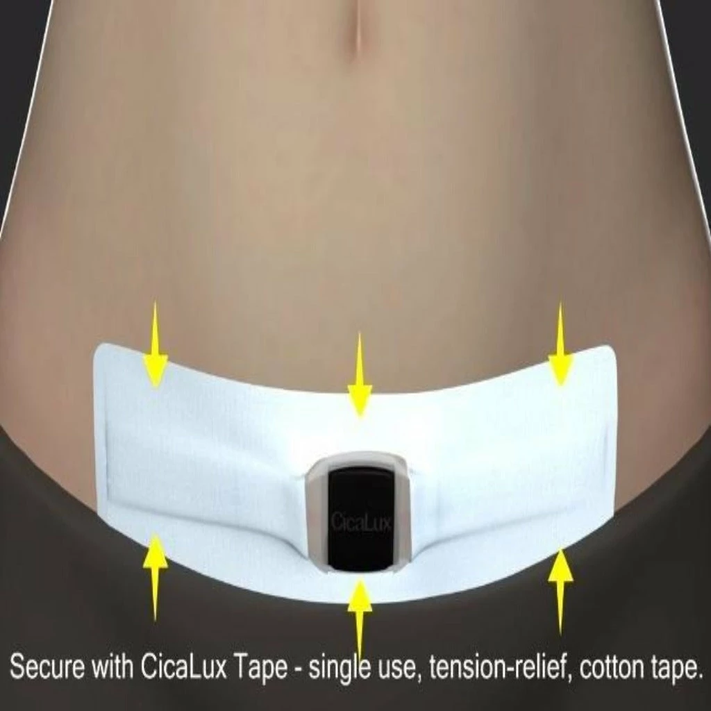 Bebelephant Award-winning CicaLux Energised Scar Care For Old And New Scars 4 Bebelephant Award-winning CicaLux Energised Scar Care For Old And New Scars